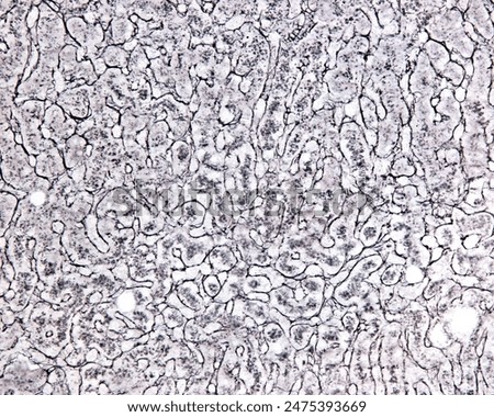 Human liver. Light microscope micrograph showing the reticular fiber meshwork associated  with sinusoids. Silver method for demonstration of reticular fibres.