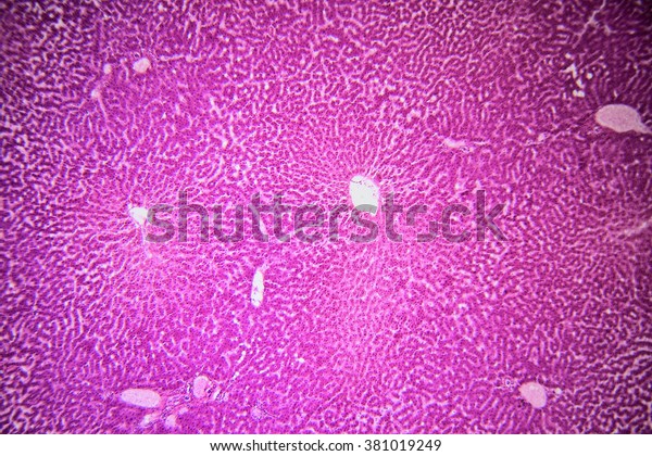 Human Liver Tissue Under Microscope Stock Photo Edit Now