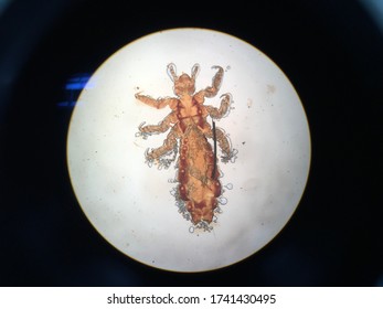 Human Louse Micro Scope View 