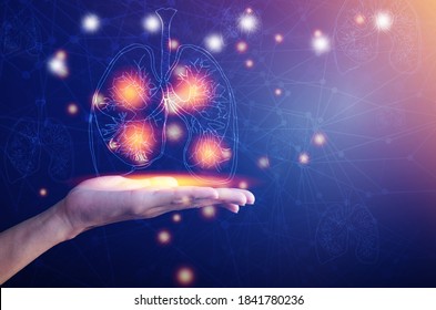 Human Lung. Lung Damage From The Corona Virus Covid 19. The Technology Concept, Doctor Holding And Diagnose Virtual Human Lungs With Coronavirus Background, Innovation And Medical Technology.