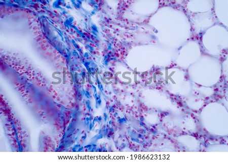 Human lung pathology under light microscope, The lungs is organs of the respiratory system in humans. Human pathology education. Haematoxylin and eosin staining technique slide.