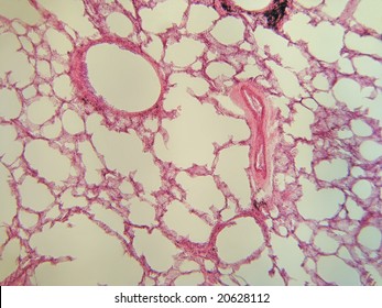Human lung tissue 100X with blood vessels