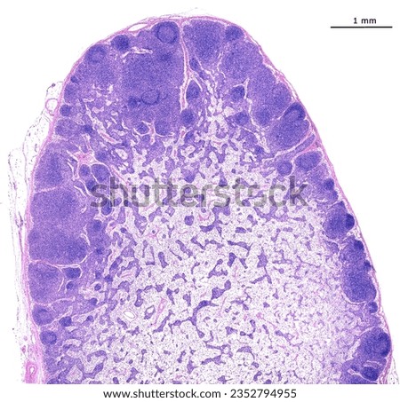 Human lymph node. The node is surrounded by a thin connective tissue capsule, and shows a peripheral cortex with follicles and paracortex and a central medulla with large sinuses and medullary cords.