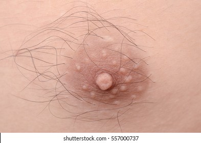 Human, Man Nipple Macro