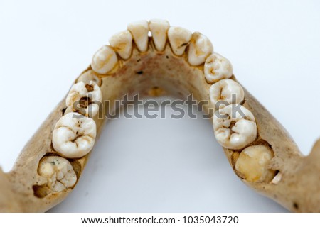 Human mandible bone