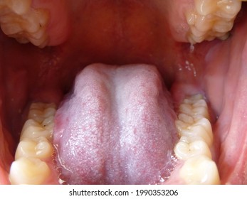 Human Mouth Open. Teeth And Tongue. Dentistry. Dental Health Care