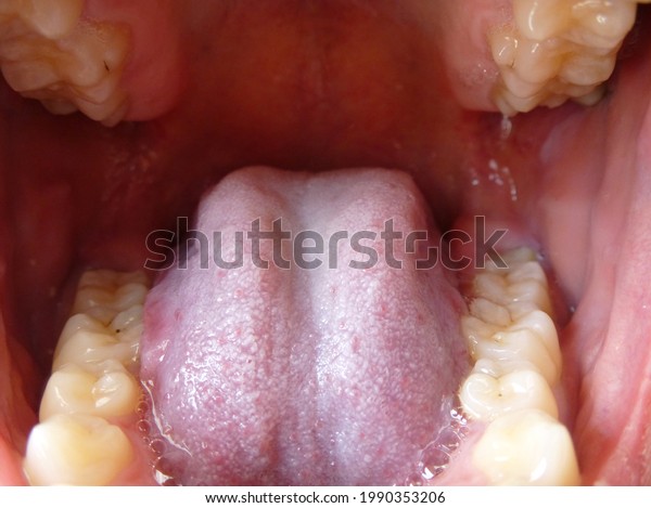Human mouth open. Teeth and tongue. Dentistry.\
Dental health care