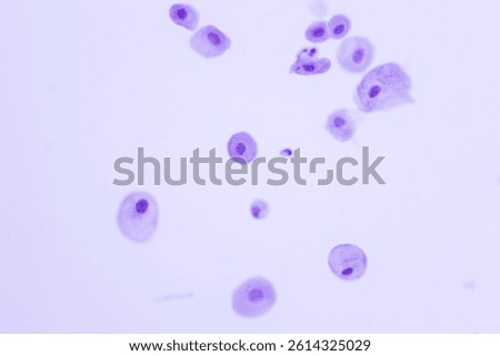 Human normal squamous epithelial cells view in microscopy.Atrophic smear criteria for pap smear slide cytology and pathology.Basal and parabasal cells on white background.