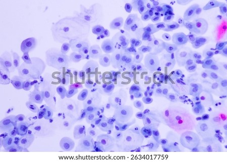 Human normal squamous epithelial cells view in microscopy.Atrophic smear criteria for pap smear slide cytology and pathology.Basal and parabasal cells on white background.