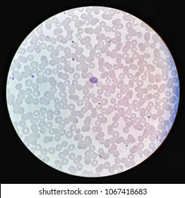 Human Parasite On Thin Film Blood Stock Photo Shutterstock