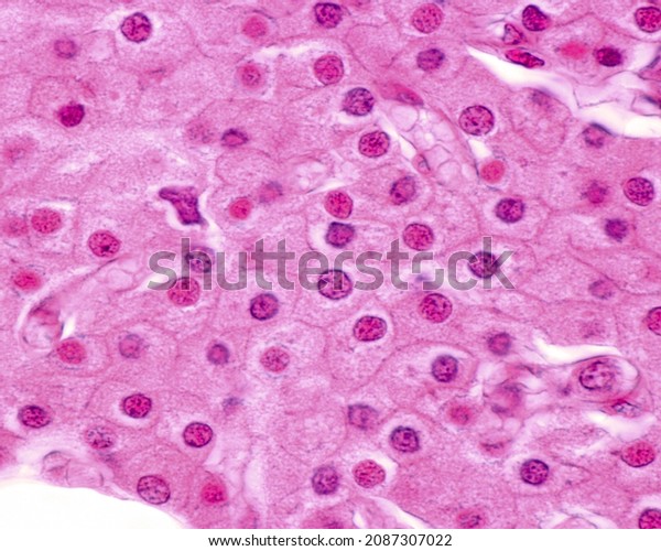 Human Parathyroid Gland High Magnification Micrograph Stock Photo (Edit ...