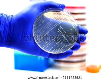 The human pathogenic bacterium Listeria monocytogenes growing in a plate of Luria agar