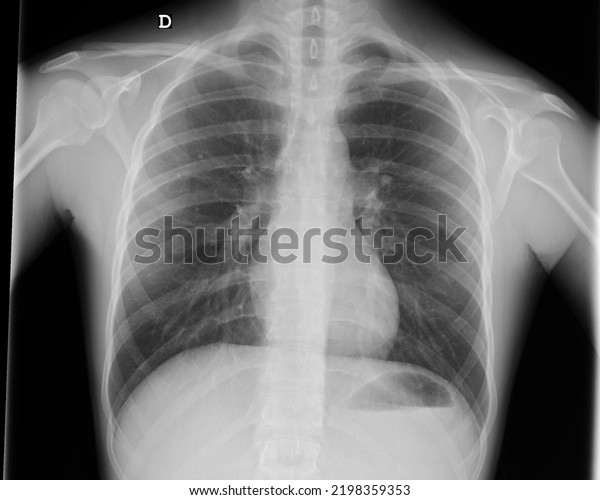 Human Pathological Anatomical Radiography Stock Photo 2198359353 ...