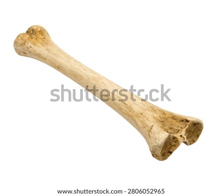Human radius bone anatomical model isolated on white background