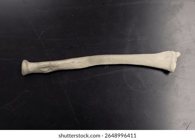 Human Radius Bone Lateral Perspective