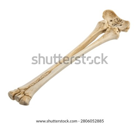 Human radius and ulna forearm bones isolated on white background