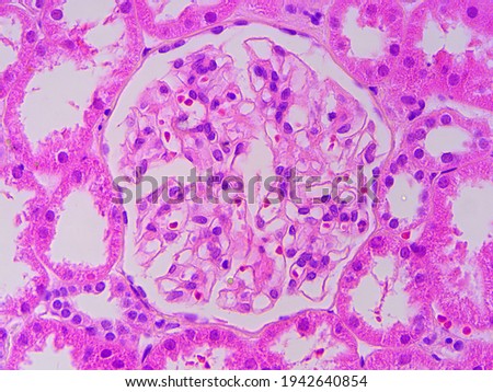Human renal corpuscle under the microscope