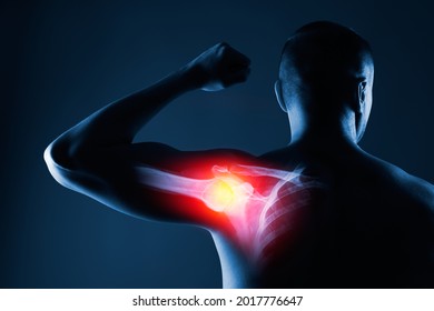 Human Shoulder Joint In X-ray On Blue Background