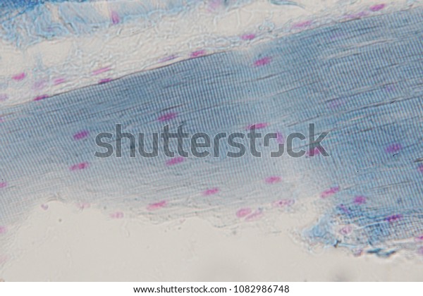 Human Skeletal Muscle Under Microscope View Stock Photo 1082986748 ...