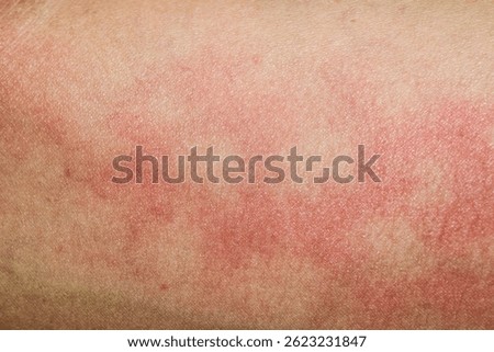 Human skin background texture dermatitis rash