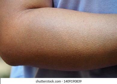 Human Skin Getting Goosebumps On Arm When Feeling Cold Or Creepy Seeing Something Haunted Or Shocked. Human Mechanism To Protect Body From Such Strong Emotional Environment. 