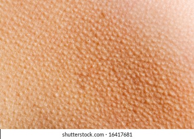 Human skin with goosebumps from the cold
