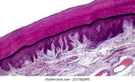Human skin. Light micrograph of epithelial tissue from the skin. Human finger section showing epidermis (stratified squamous epithelium), dermis and connective tissues. Hematoxylin and Eosin Staining.