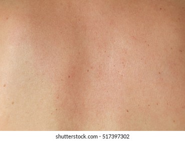 human skin texture stock photo image 76786839 human skin texture images stock photos vectors human skin texture stock photo image 76786839 human skin texture images stock photos vectors