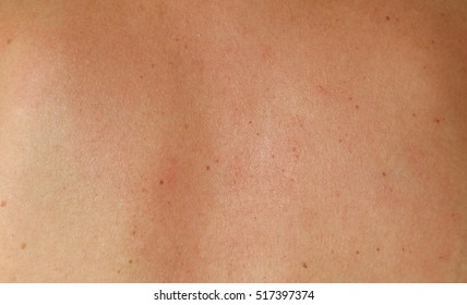 Human skin texture. skin of woman 