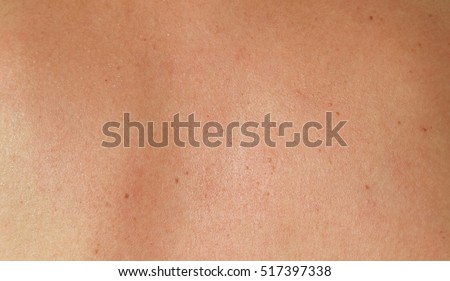 Human skin texture. skin of woman 