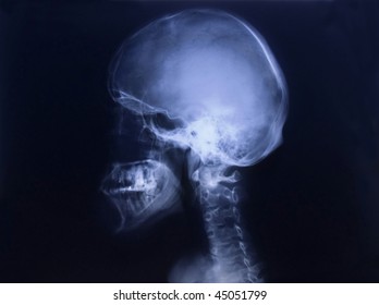 Human skull - showing X-ray building of skeleton of man and some internal organs