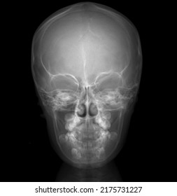 Human Skull Xray  AP Position Front Face Image