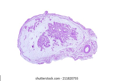 Human Spermatic Cord: a microscope slide cross section shows the vas (ductus) deferens (right small circle) and pampiniform plexus. Increased details are due to stacked images. Isolated on white. 
