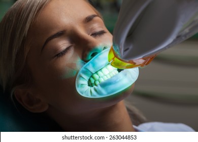Human Teeth, Whitening, Dentist.