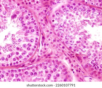 Human testicle. In the center of the image, among seminiferous tubules, a group of polyhedral epithelioid cells (Leydig cells) can be seen - Shutterstock ID 2260107791