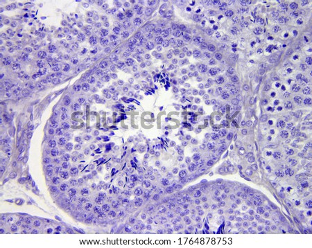 Human testis section under the microscope