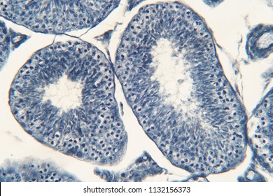 Human Testis Under Microscope View Shows Stock Photo (Edit Now) 1132156373