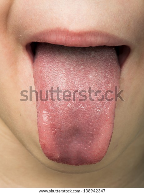 Human tongue\
protruding out. Child\
tongue.
