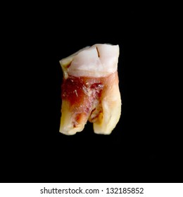 Human Tooth Pulled Stock Photo 132185852 | Shutterstock