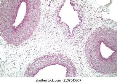 Human Umbilical Chord, Brigtfield Photomicrograph. During Prenatal Development, The Umbilical Cord Is Physiologically And Genetically Part Of The Fetus And Normally Contains Two Arteries And One Vein.