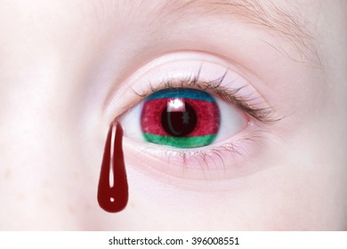 human's eye with national flag of azerbaijan with bloody tears. concept - Shutterstock ID 396008551