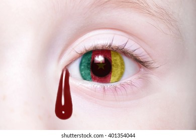 human's eye with national flag of Cameroon with bloody tears. concept - Shutterstock ID 401354044