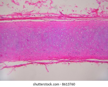 Hyaline Cartilage With Chondrocytes.