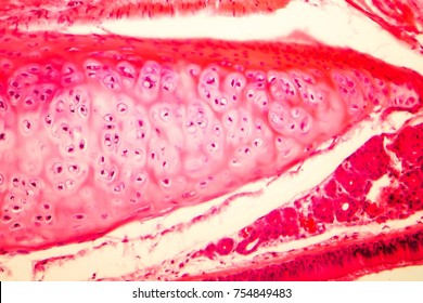 Hyaline cartilage of human trachea, light micrograph