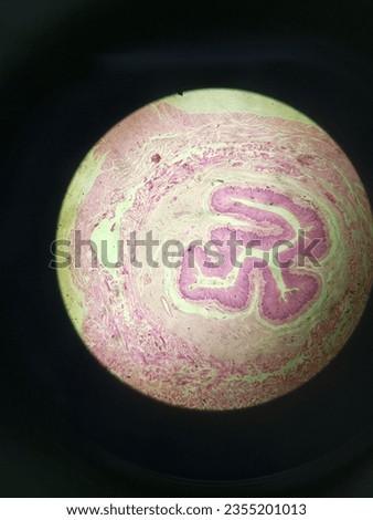 Hyaline cartilage is a type of connective tissue that provides structure and support to various parts of the body. It's characterized by its translucent appearance under a microscope due to collagen.