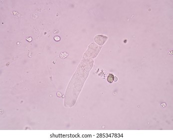 1,183 Hyaline Images, Stock Photos & Vectors | Shutterstock