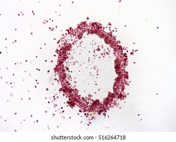 Hydra, cross section under the microscope