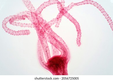 Hydra Is A Genus Of Small, Fresh-water Animals Of The Phylum Cnidaria And Class Hydrozoa.