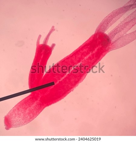Hydra sp. Cnidarian Under Microscope