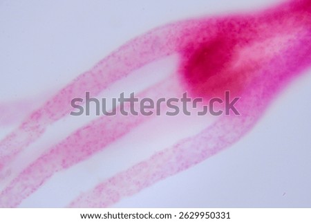 Hydra under microscope showing tentacles and body structure